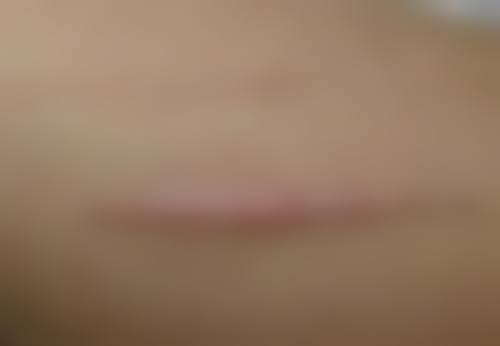 五、怎么去掉熬夜眼袋之注意事项