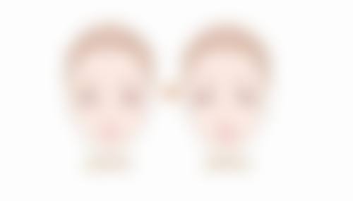 平行双眼皮适合什么眼型的人？眼裂长、眼皮薄且无赘皮者是理想之选 