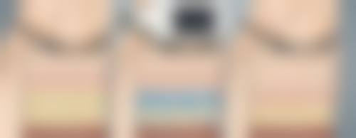 四、溶脂和抽脂的风险区别