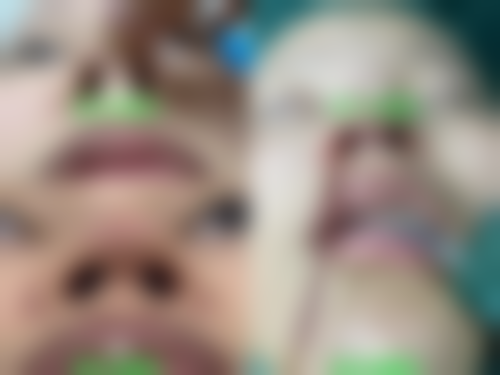 五、韶关三美牙科门诊部价格表