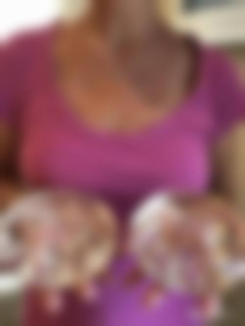 九、深圳天美整形美容门诊部真实的患者评价