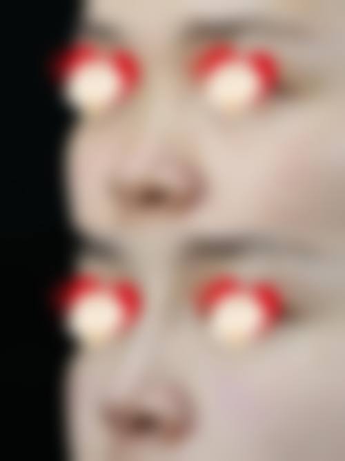 四、KIBBUM整形医院特色项目