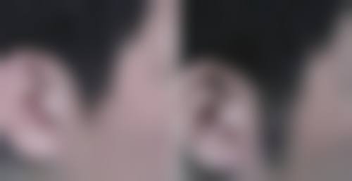 七、诸暨新生植发预约方式