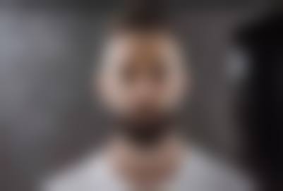 二、诸暨新生植发怎么样？