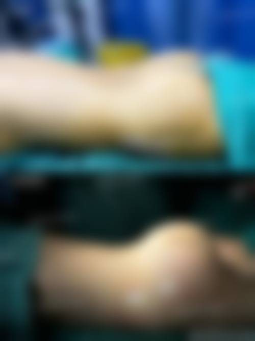 四、首都医 科 大学附属北京同仁医院(医学美容中 心)特色项目