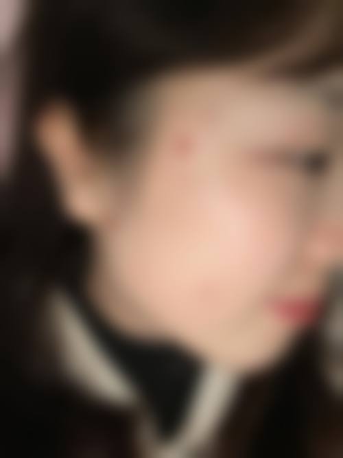 七、无锡臻爱荟整形医院预约方式