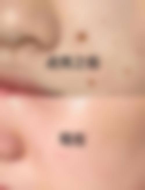 四、无锡臻爱荟整形医院特色项目