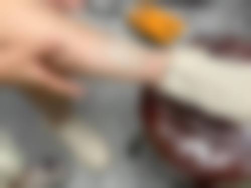 八、杭州师范大学附属医院(烧伤整形美容科)真实的患者评价