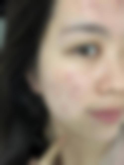 八、KIBBUM整形医院真实的患者评价