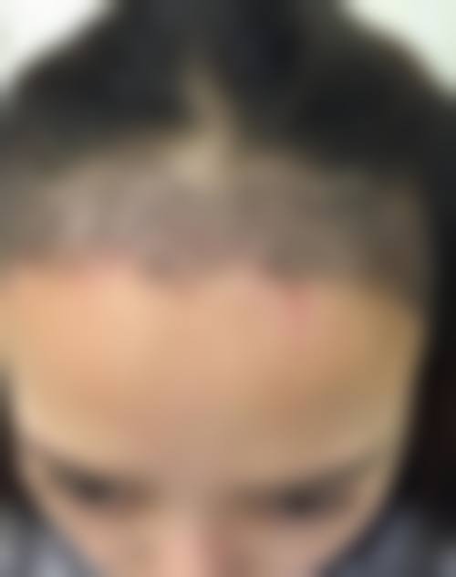 三、青穗植发连锁诊疗项目有哪些？