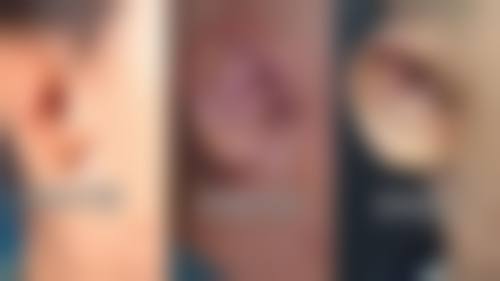 二、无锡臻爱荟整形医院怎么样？