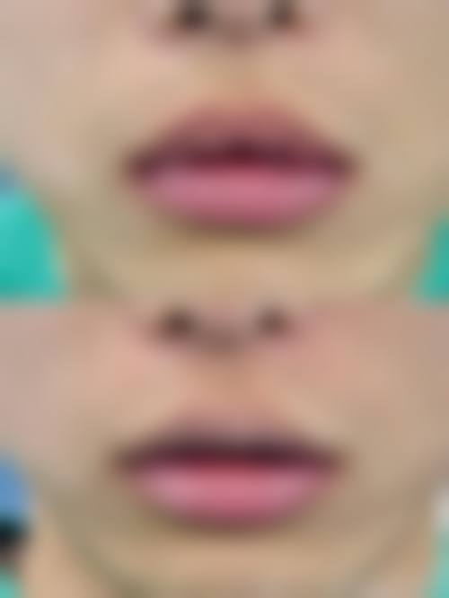 四、青穗植发连锁特色项目