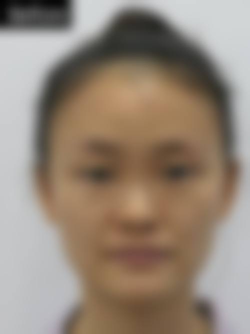 八、南宁爱思特医疗美容医院预约方式