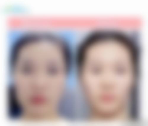 四、深圳悦美佳医疗美容诊所特色项目