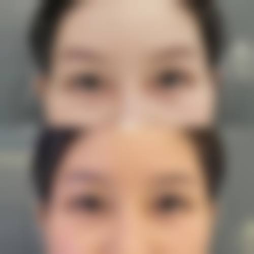 八、无锡臻爱荟整形医院真实的患者评价