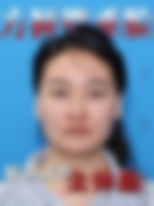 二、杭州师范大学附属医院(烧伤整形美容科)怎么样？