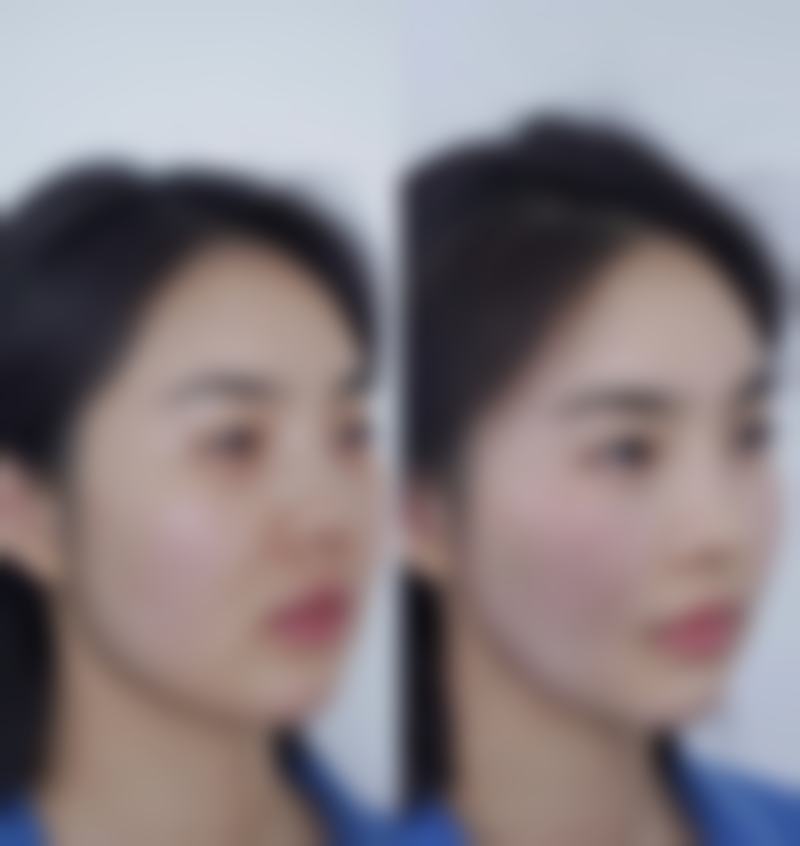 四、术前注意事项