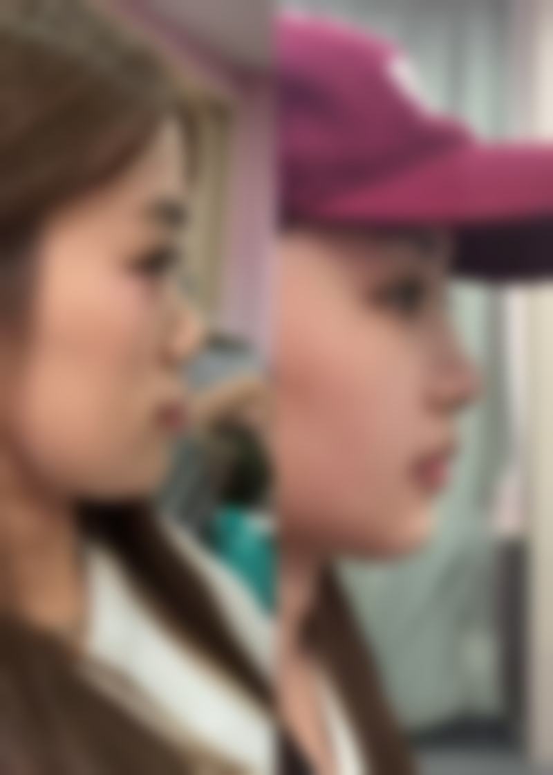 九、常州美之术医疗美容诊所真实的患者评价