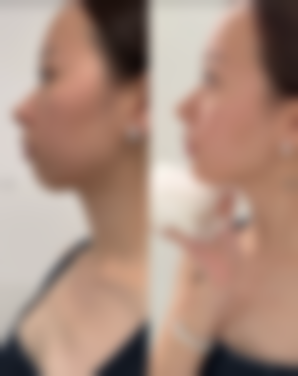 九、武汉小忠丽格医疗美容门诊部真实的患者评价