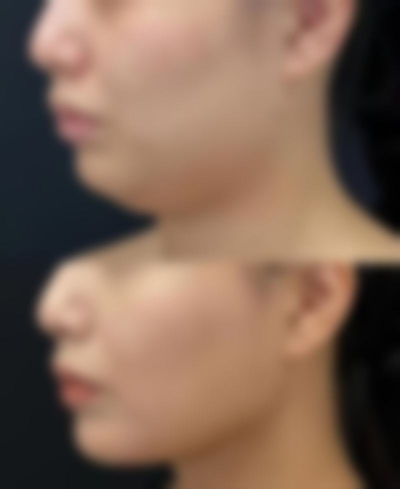 二、合肥博仕医疗美容门诊部怎么样？