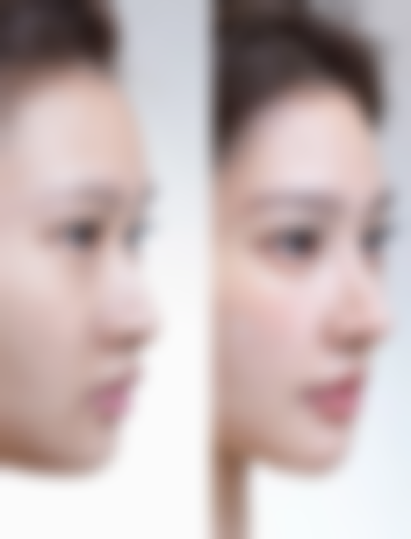 八、青穗植发连锁真实的患者评价