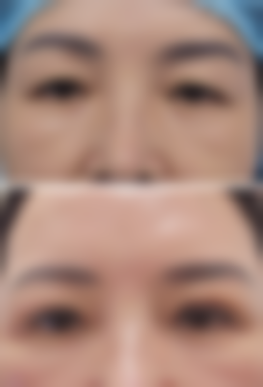 八、信阳沐辰尚美医疗美容门诊部真实的患者评价