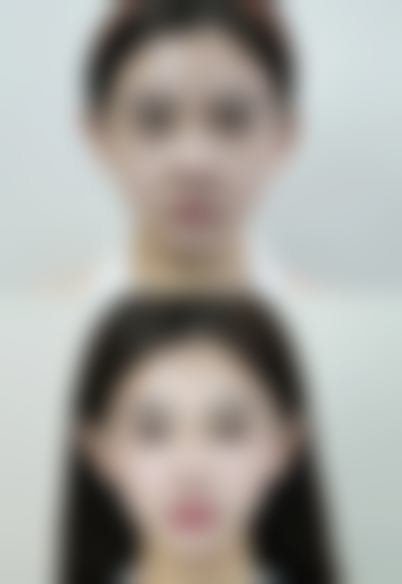 二、溶脂和抽脂的适用部位与成效区别