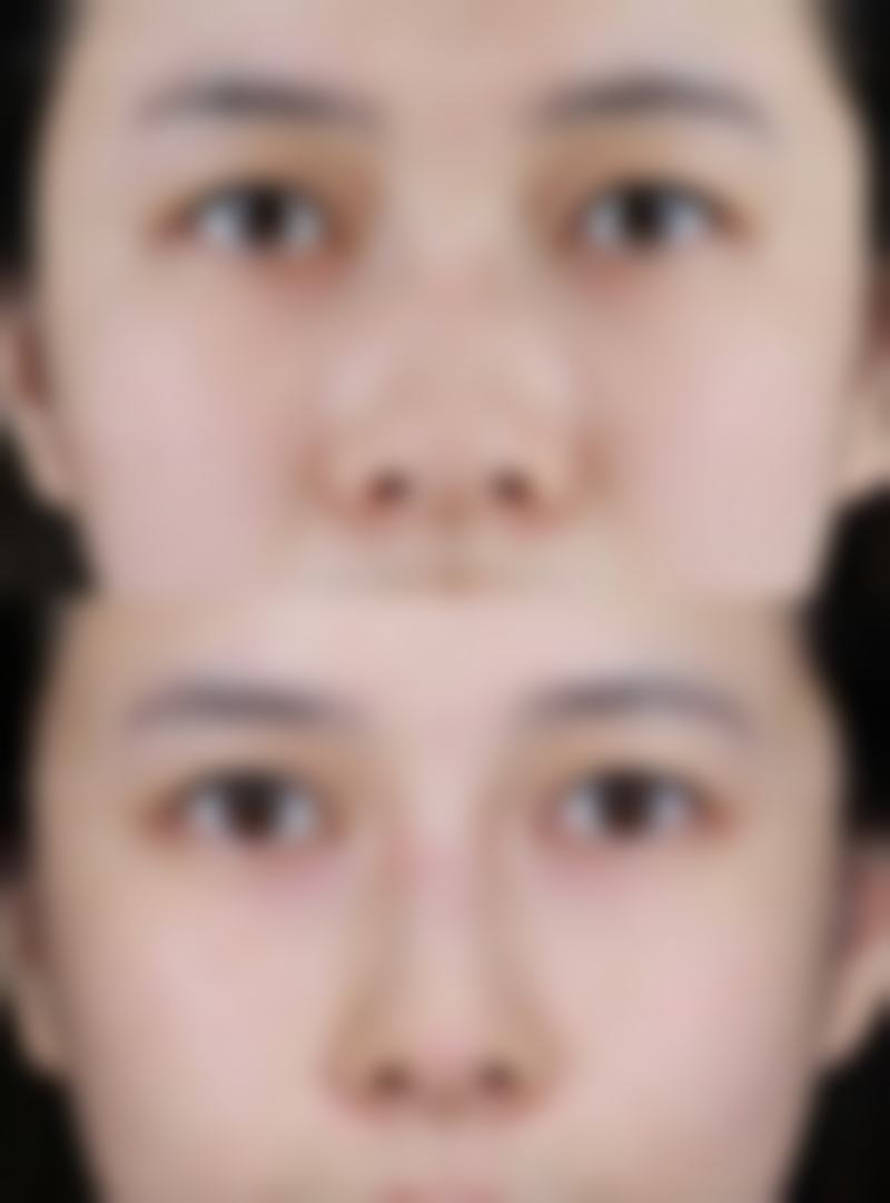 五、信阳沐辰尚美医疗美容门诊部价格表