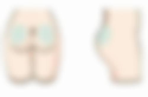 二、冰肉瘦脸针的适用情况