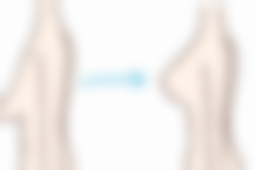 五、种植的头发烫染的注意事项