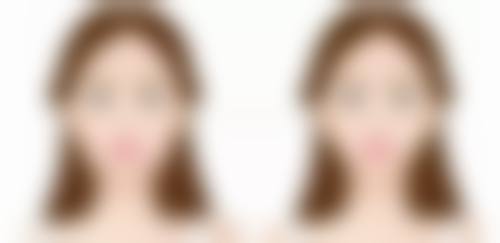 补中益气丸可以治疗眼袋吗？适用情况、服用方法与日常改善眼袋建议全解析 