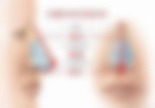 四、补中益气丸治疗眼袋的适用情况