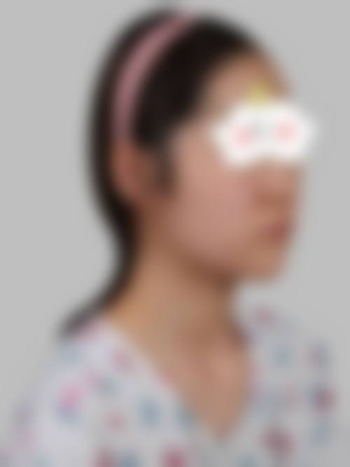 八、苏州美丽港湾整形医疗美容医院真实的患者评价