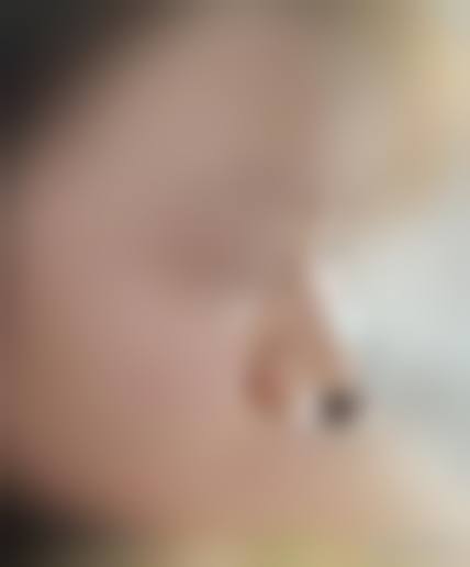 二、沈阳小树医疗美容怎么样？