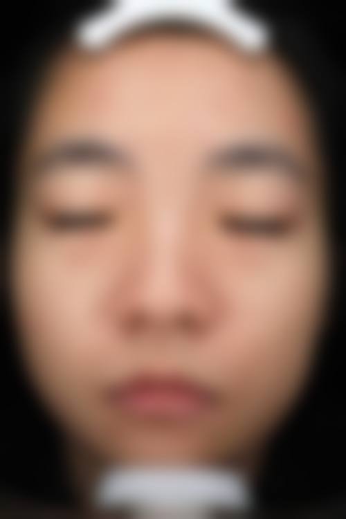 四、青岛朝晖整形医院特色项目