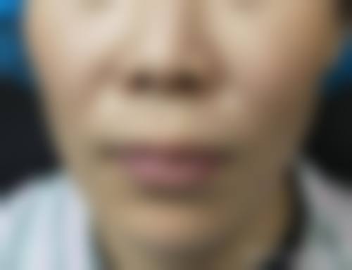 四、西宁韩美植发美容医院特色项目