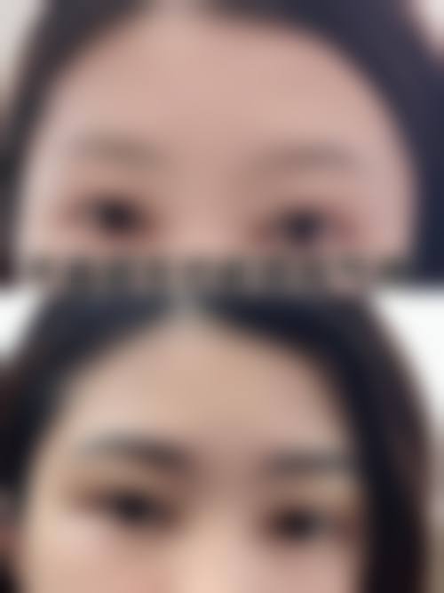 四、西宁韩美植发美容医院特色项目