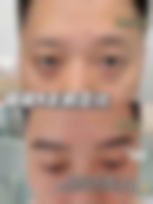 九、西宁韩美植发美容医院真实的患者评价