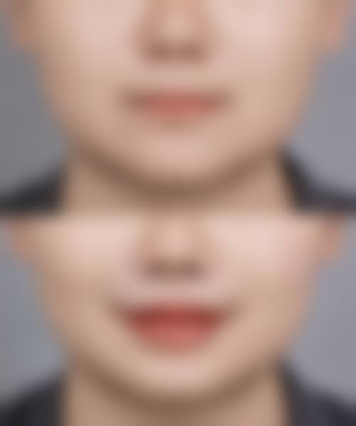 七、长沙半岛整形医院预约方式