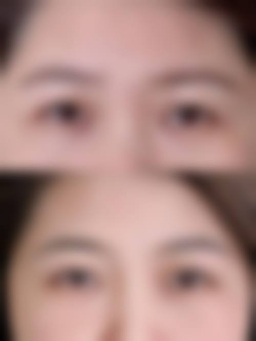 五、上海美希整形医院价格表