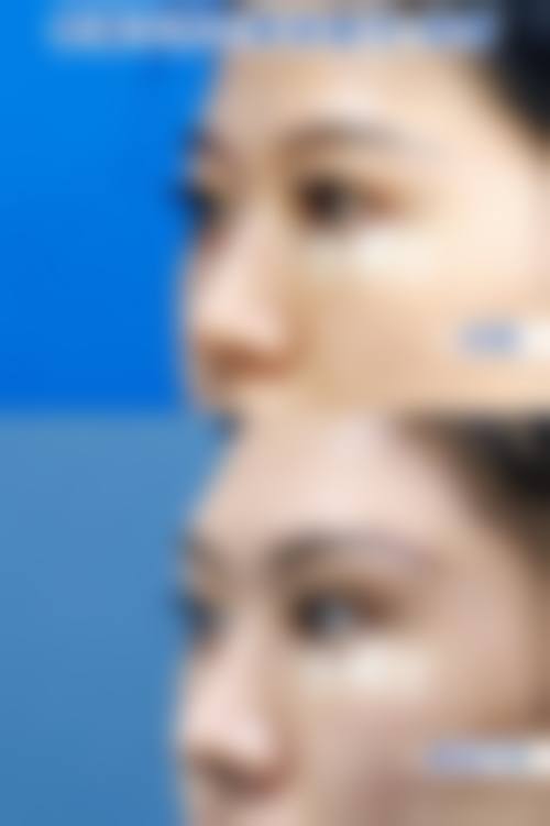 五、青岛朝晖整形医院价格表