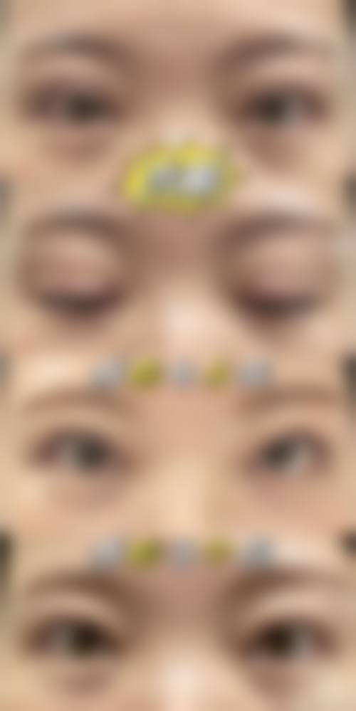 二、南京安安医疗整形美容医院怎么样？