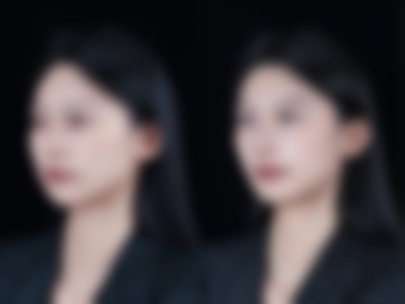 八、抚州高新区慧和医疗美容诊所预约方式