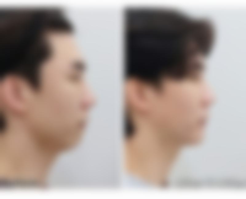 一、补中益气丸的基本信息及作用