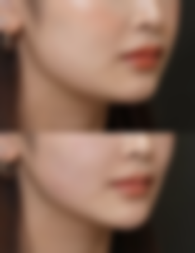 二、疤痕疙瘩有自我修复吗：无法自愈的原因