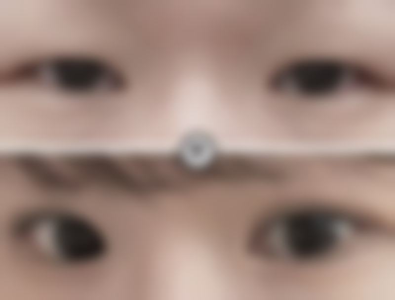 四、重庆渝中术妍医疗整形美容特色项目