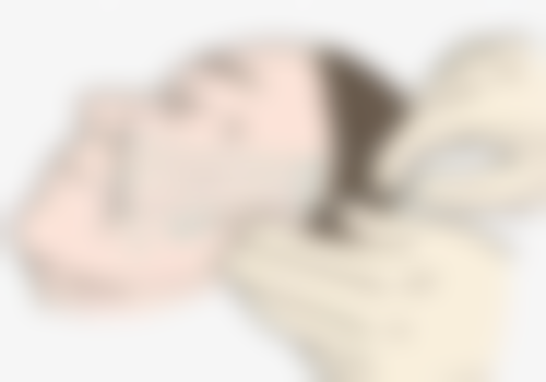 二、陈旧性凹疤痕的类型评估