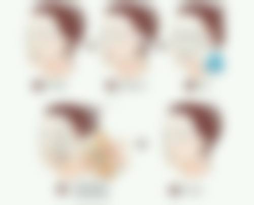 六、陈旧性凹疤痕治疗的注意事项