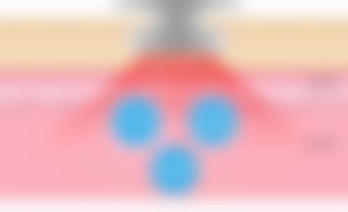 六、审美与大众看法：孟子义双眼皮是不是割的影响