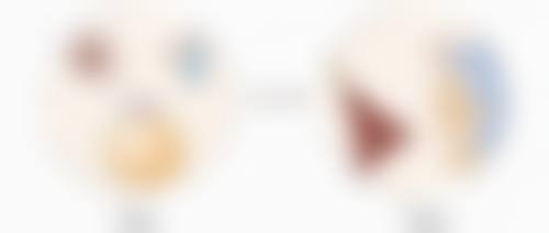 五、眼综合双眼皮手术的风险提示